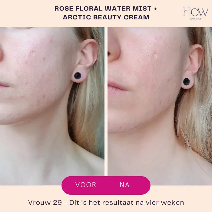 Creme droge huid resultaat