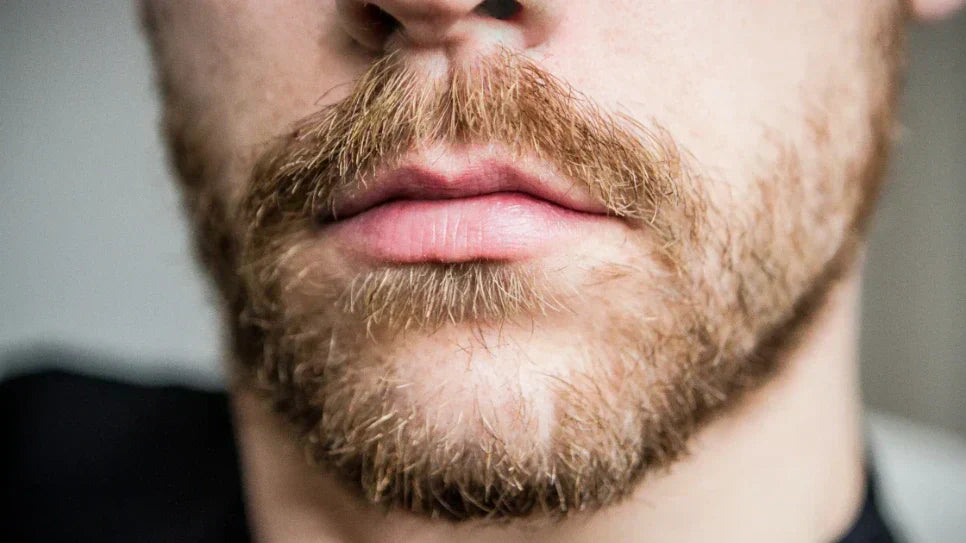 Schilfers in je baard