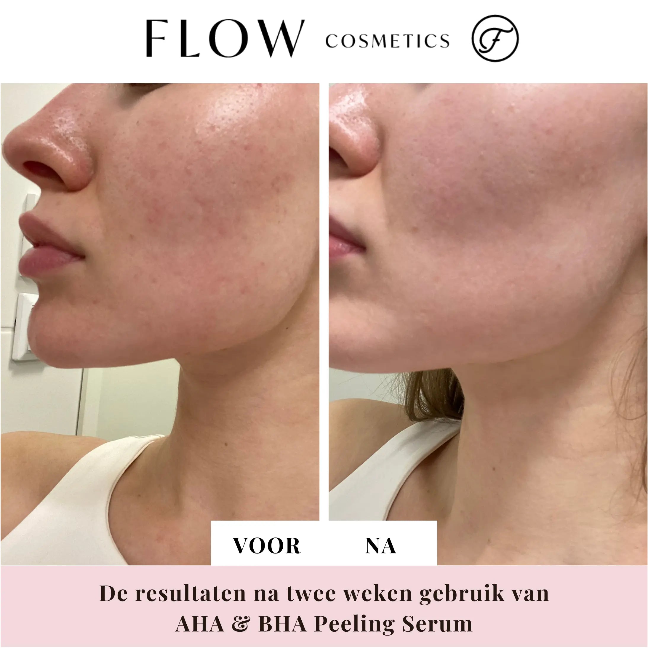 Peeling serum met AHA & BHA | Flow Cosmetics