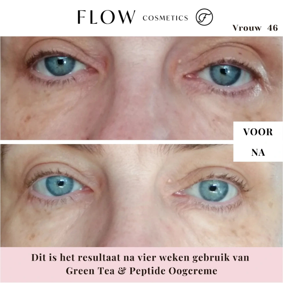 natural eye cream result