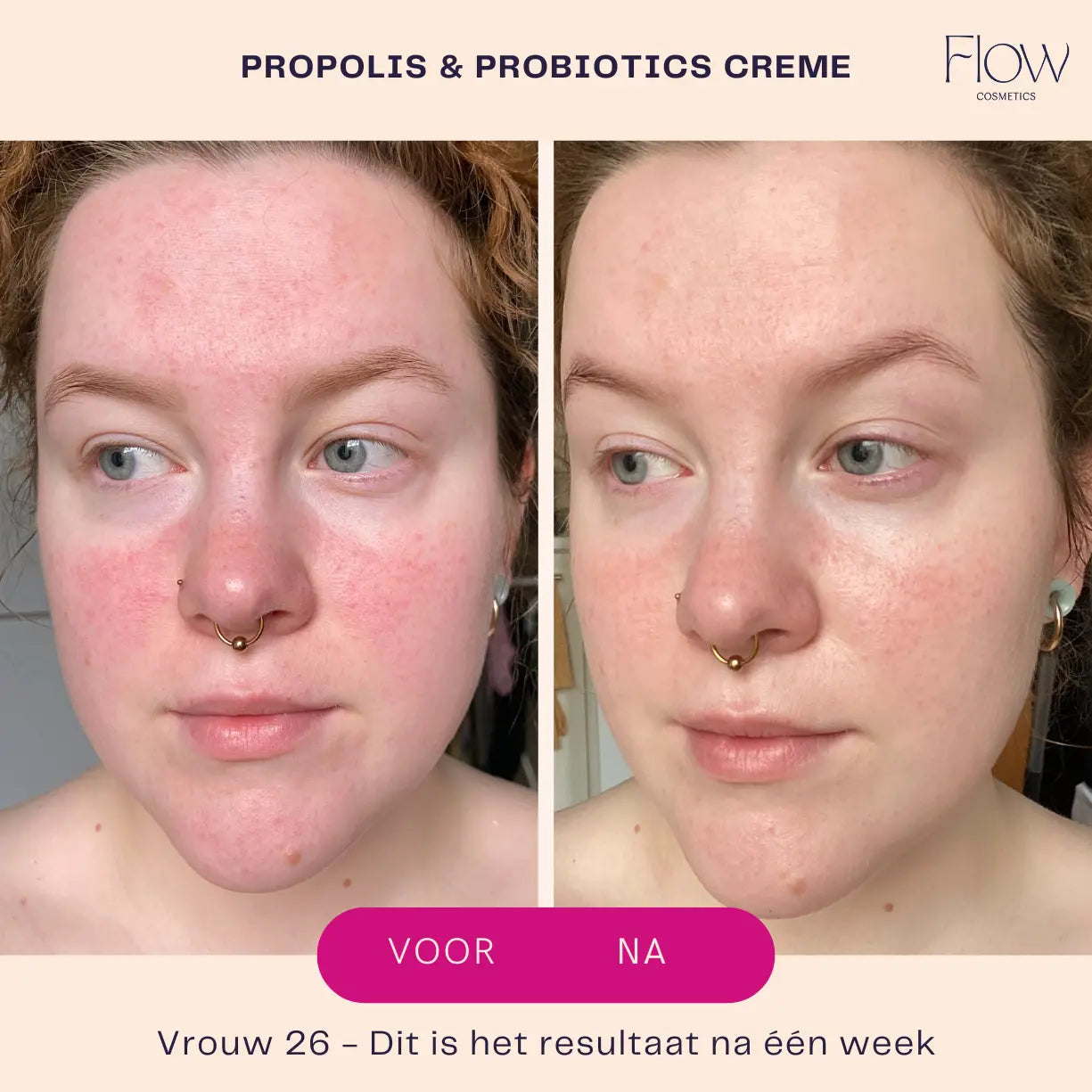 Propolis cream resultaat
