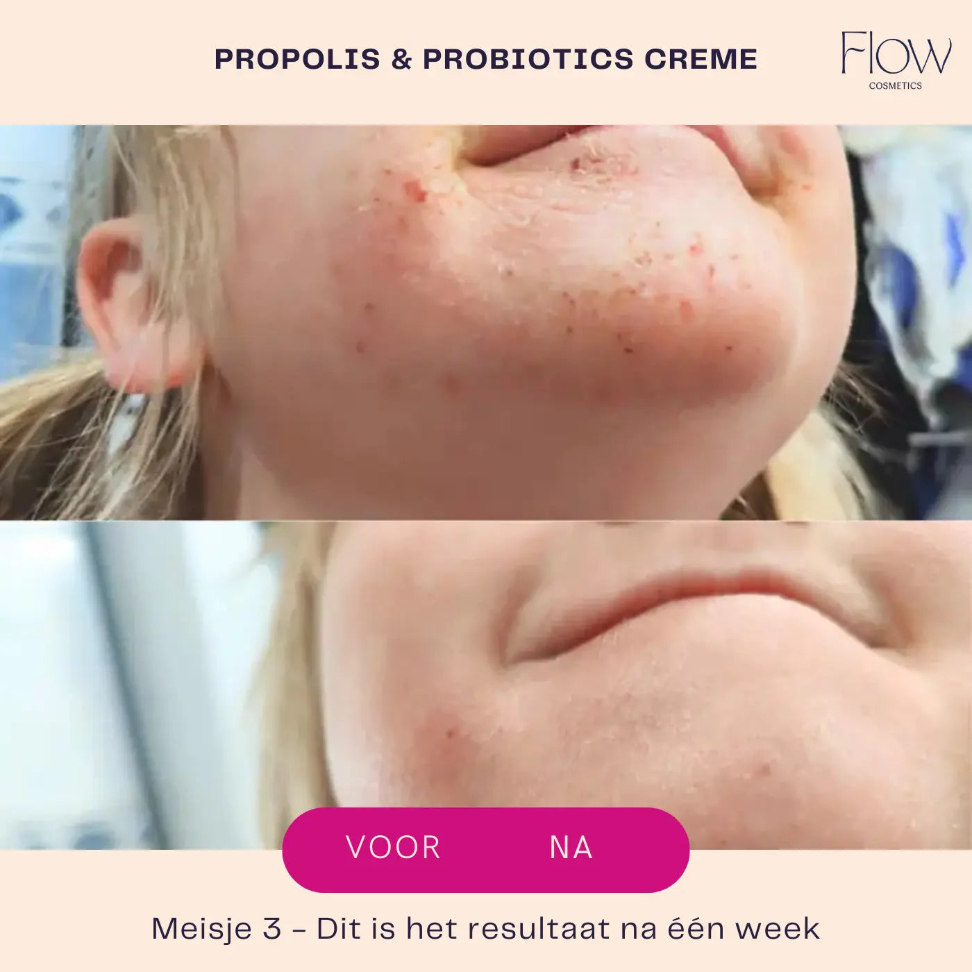 propolis results