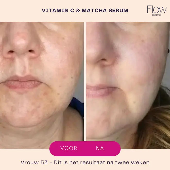 Vitamin C matcha serum