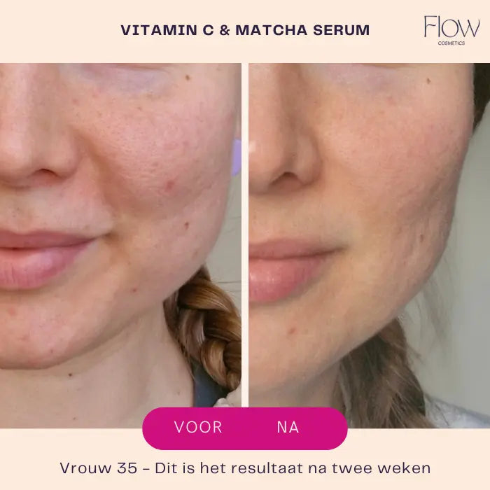 Vitamin C matcha serum
