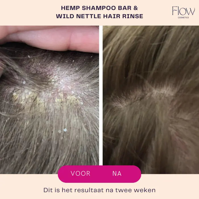 haarspoeling azijn